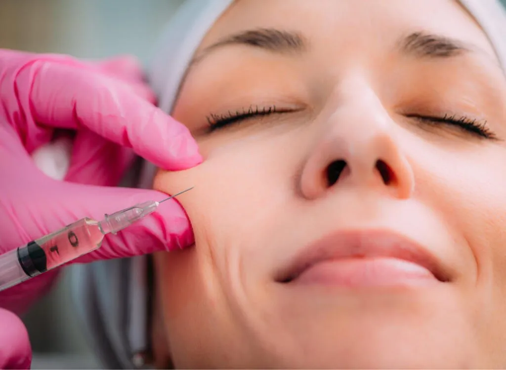 Dermalfiller für Wangen